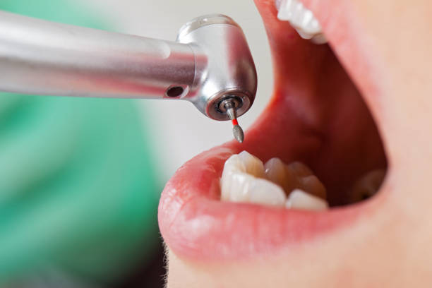 Best Emergency Dental Surgery in Seneca, MO